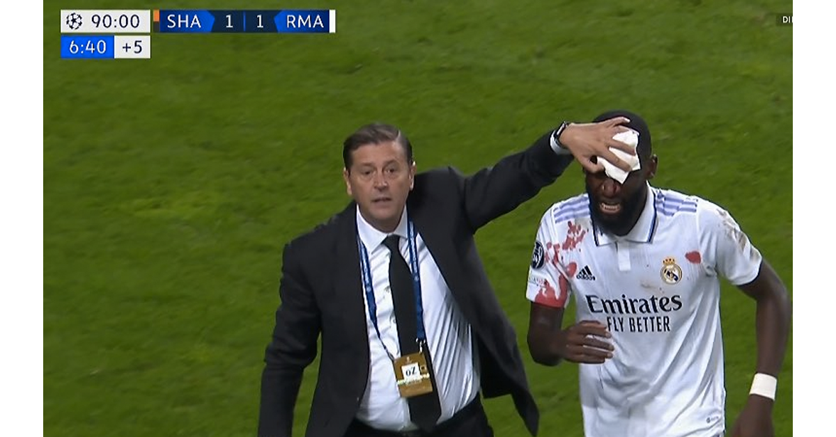 Rüdiger da empate de último minuto al Real Madrid y termina sangrando