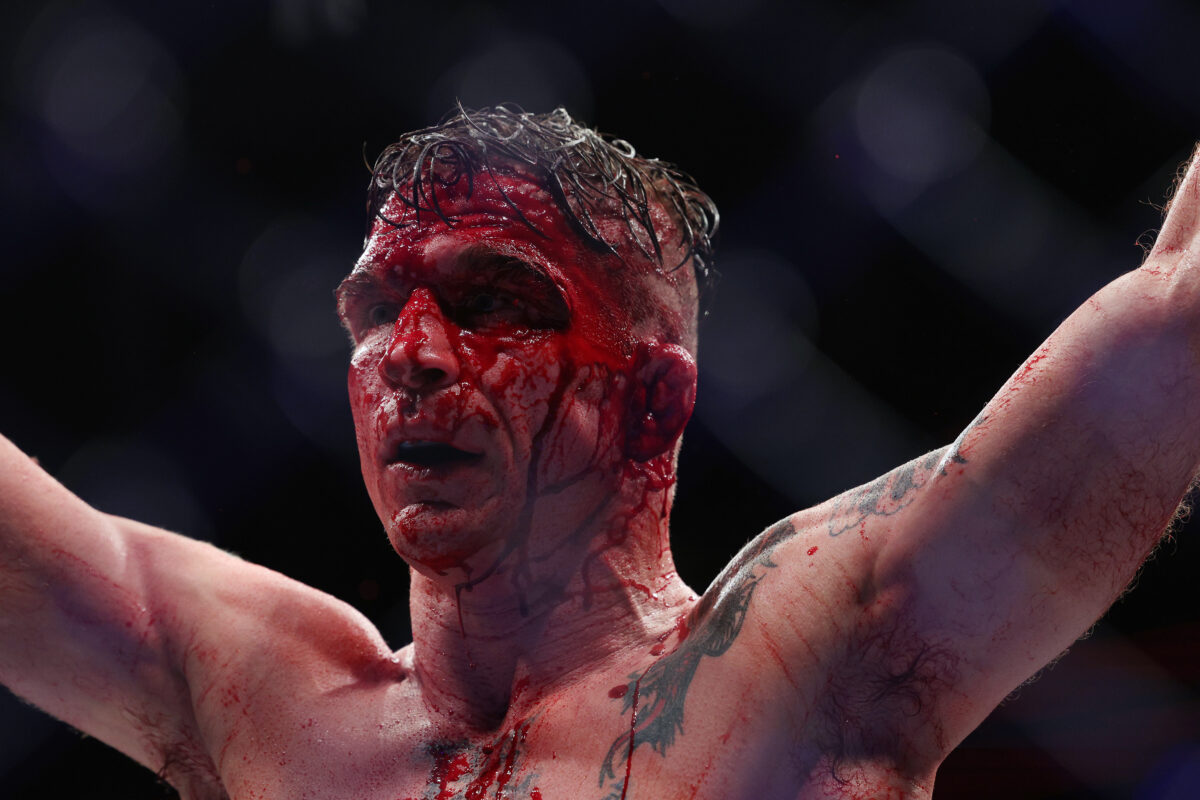 Darren Elkins reveals assortment of leg injuries suffered at UFC on ESPN 42