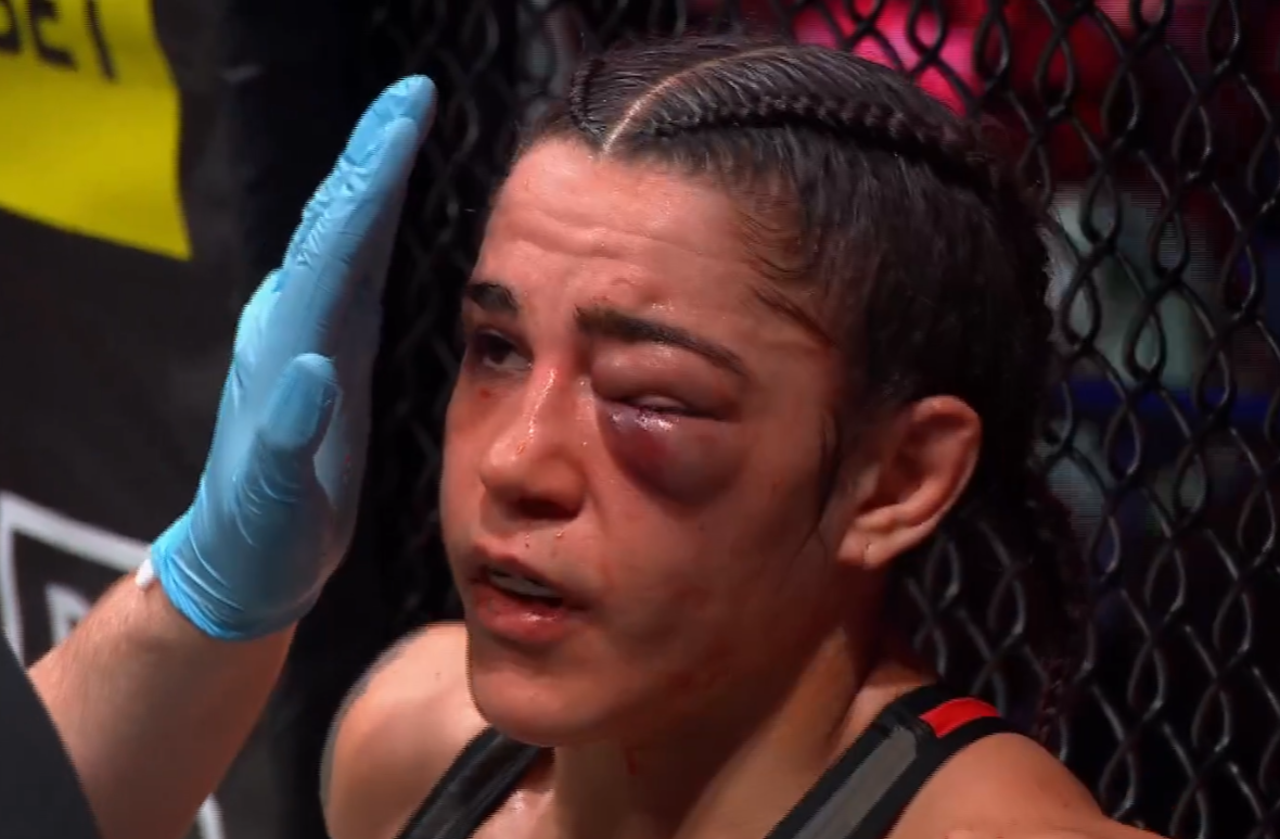 2023 PFL Europe 4 video: Bulging eye injury causes halt to Dakota Ditcheva vs. Valentina Scatizzi