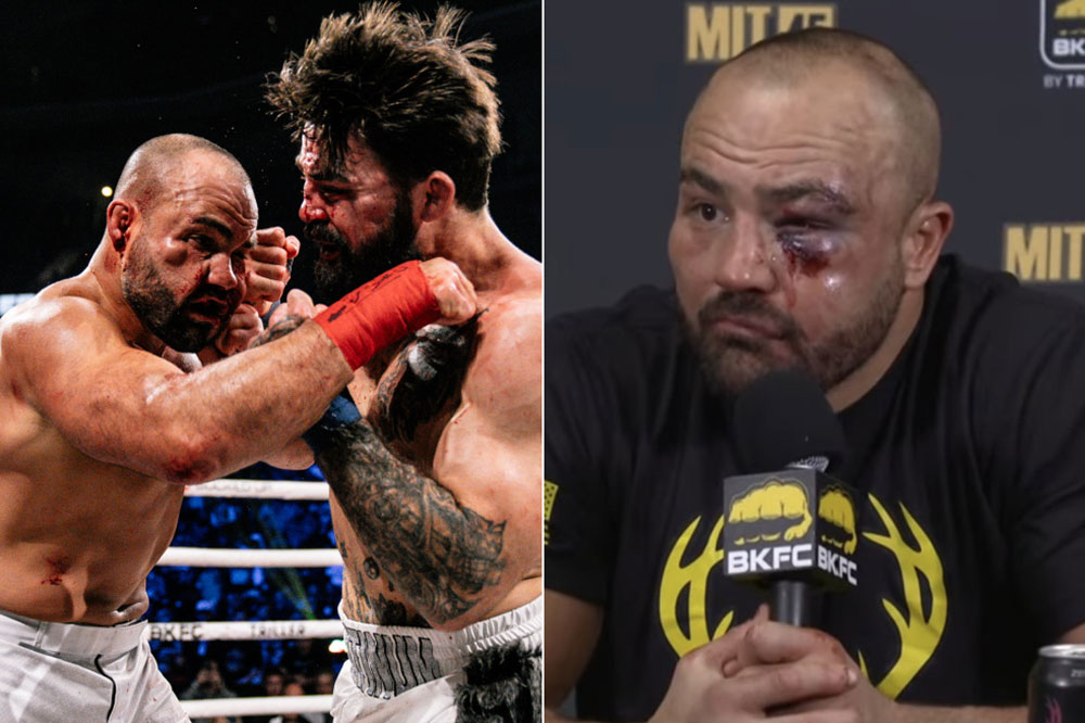 Eddie Alvarez says he suffered two orbital fractures in wild fight with Mike Perry at BKFC 56