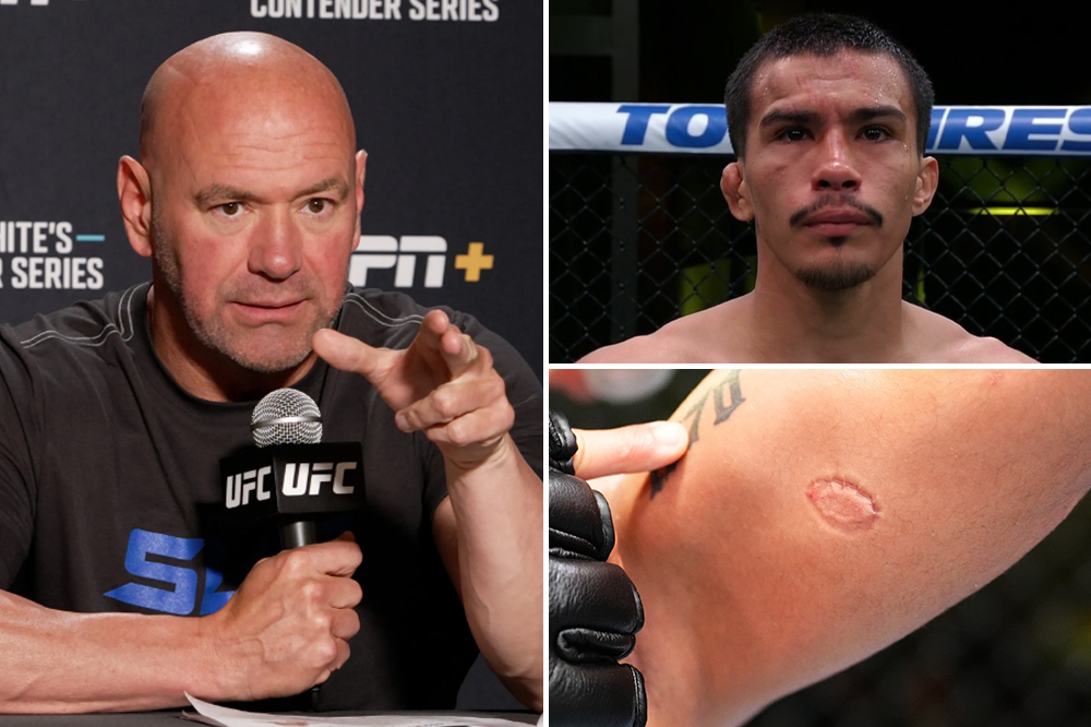‘Now you get cut’: Dana White removes Igor Severino from roster after UFC on ESPN 53 biting disqualification