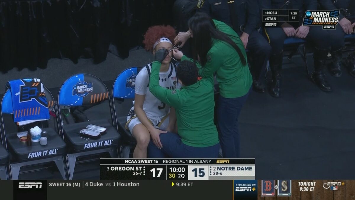 Refs made Hannah Hidalgo remove her nose stud mid-game vs. Oregon State despite wearing it during the season